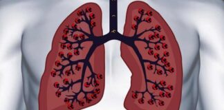 Health tips for healthy lungs