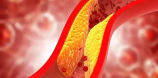 Cholesterol how armful to your health.