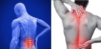 home remedy for back pain