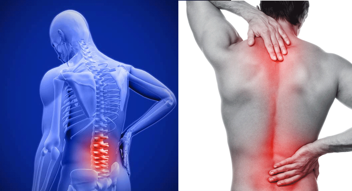 Back Pain : వెన్ను నొప్పి సమస్యతో బాధపడుతున్నారా? ఇంటి చిట్కాలతో ఉపశమనం పొందవచ్చు. home remedy for back pain