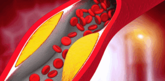 If you use this oil the cholesterol in the blood will decrease