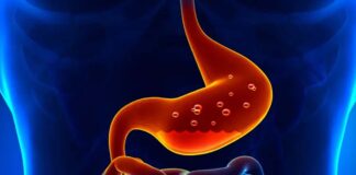 Even if you suffer from acidity problems, this mixture is enough
