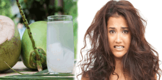 If dandruff and dry hair problems are haunting you, then do this