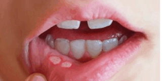 If oral problems are haunting you then follow these tips