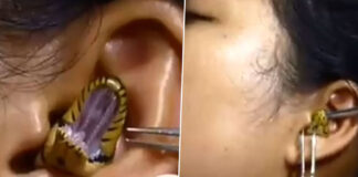 snake gets into ear of a woman video viral