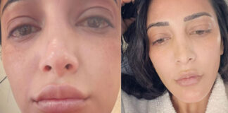 what happened to shruti haasan she shares her photos