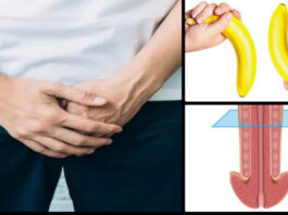 are-you-suffering-from-dysfunction-follow-these-tips
